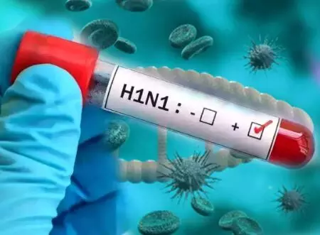 Swine Flu H1N1 in Durg Bhilai: दुर्ग-भिलाई में स्वाइन फ्लू के दो नए मरीज, जानिए H1N1 के लक्षण और बचाव के उपाय