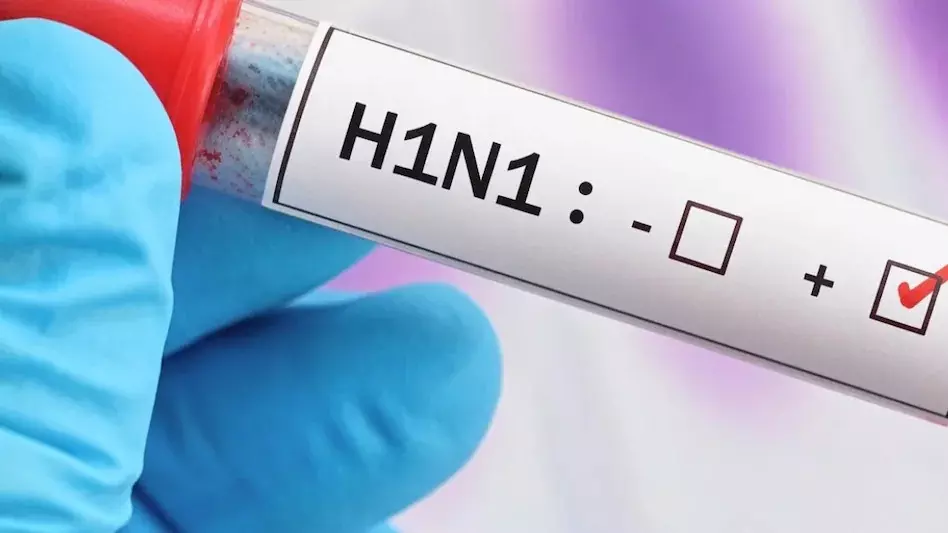 Swine Flu : H1N1 ने बढ़ाई चिंता, 36 मरीज मिले, आधे से ज्यादा बच्चे-किशोर Swine Flu : H1N1 ने बढ़ाई चिंता, 36 मरीज मिले, आधे से ज्यादा बच्चे-किशोर