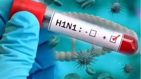Chhattisgarh Swine Flu Alert: छत्तीसगढ़ में स्वाइन फ्लू ने बढ़ाई चिंता, 122 एक्टिव मरीज; संक्रमितों की संख्या 344 के पार Chhattisgarh Swine Flu Alert: छत्तीसगढ़ में स्वाइन फ्लू ने बढ़ाई चिंता, 122 एक्टिव मरीज; संक्रमितों की संख्या 344 के पार