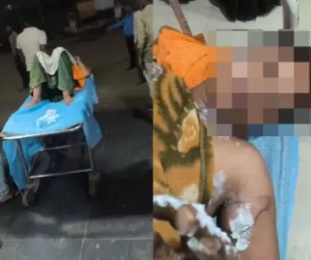MP News : पति ने पत्नी पर पेट्रोल डालकर लगाया आग, गंभीर हालत में अस्पताल में भर्ती, जानें क्या है वजह MP News : पति ने पत्नी पर पेट्रोल डालकर लगाया आग, गंभीर हालत में अस्पताल में भर्ती, जानें क्या है वजह